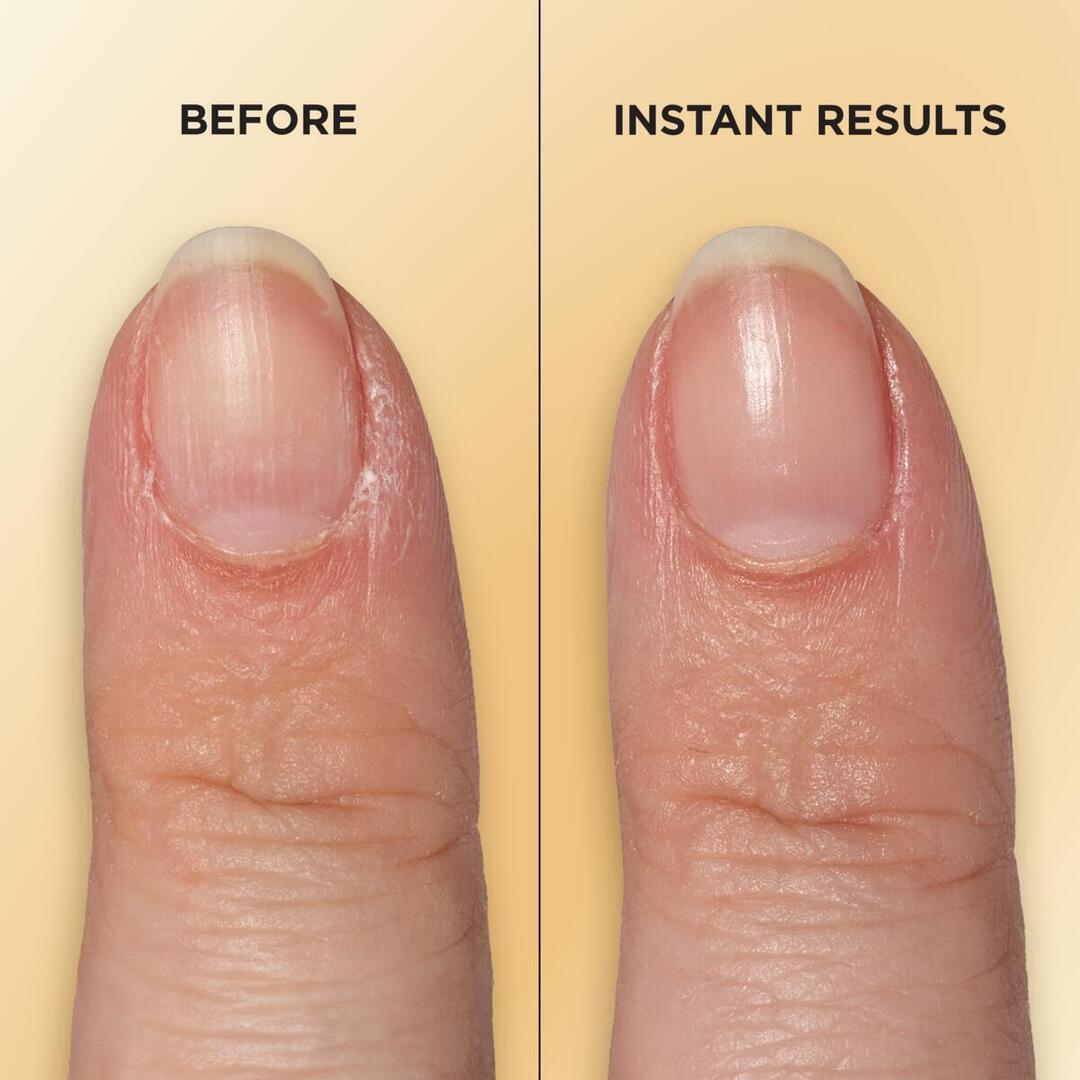 Vitamin E Nail & Cuticle Oil Pen - US 5599